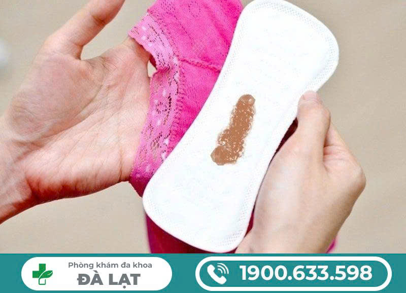 Hình ảnh minh họa